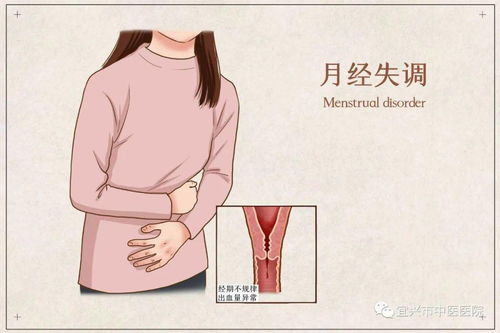 月经不调的烦恼