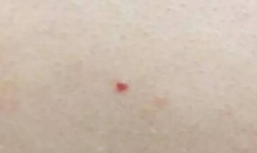 四、  胎记算命的深层逻辑：天干地支与藏露之辨