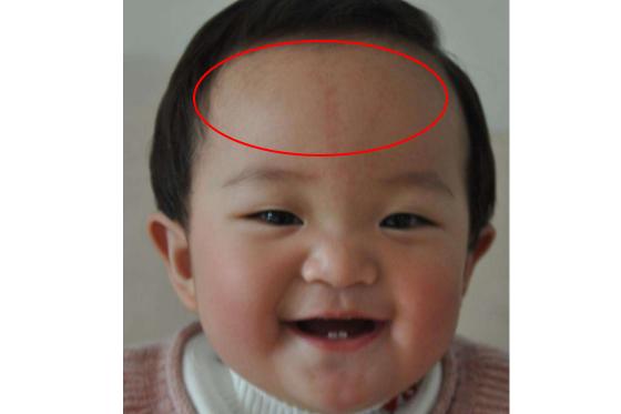 额头宽阔：智慧与事业心的双重加持