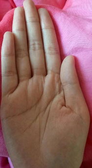 二、 智慧线（额头线）附近的星纹