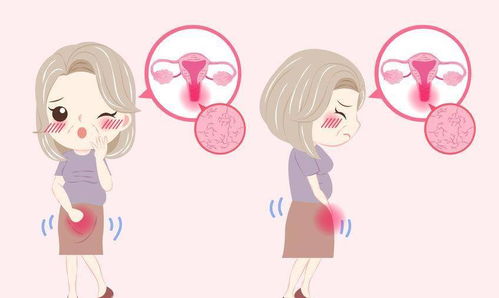 乳头肤质