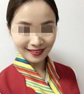 2. 鼻梁高挺——山根丰隆、 鼻翼饱满