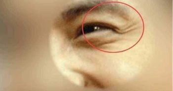 面部比例与轮廓的和谐美学