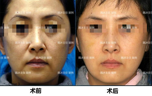 三、 案例解析：社会周边环境现实中的困境与应对