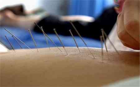 针灸治疗时女性患者是否需要考虑风水因素？