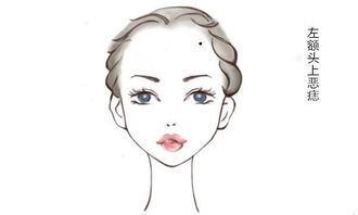 （一）左上额痣——所谓“泪痣”的情感指示器