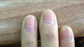 三、  百合形状的指甲：温顺性格与旺盛桃花运的统一