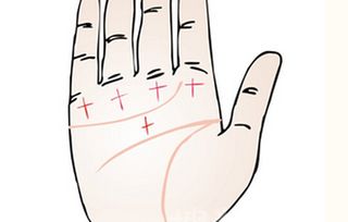 手相中天医纹和十字纹分别代表什么含义？