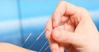 三、  针灸与穴位疗法：经络刺激对气机升降的调节作用