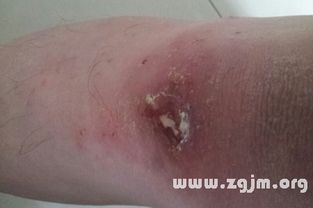 梦见屎溅到自己身上是什么征兆或含义？