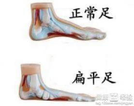 闭眼单脚站立测试时，摇晃是允许的吗？