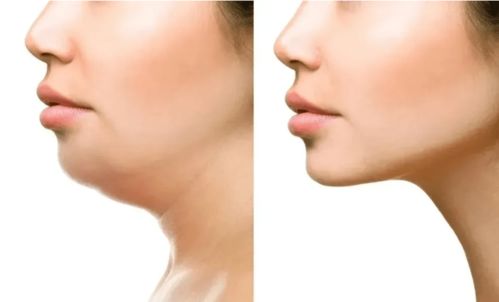 下巴圆润耳垂厚实：稳重可靠的人格魅力