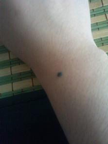 第一部分：基于组织病理学的生理学分析