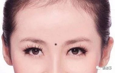 眼尾附近的“眼缘”