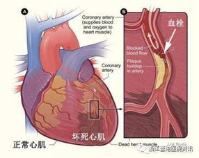 现代医学视角下的内皮机能与手部症状