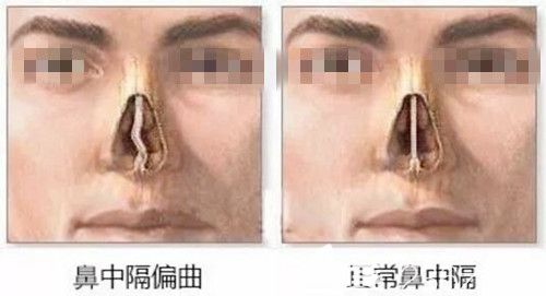 三、 医治方式之选择标准