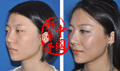 1. 面相学视角下的大鼻意义阐释