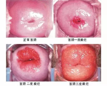 物理医治：迅速有效的选择