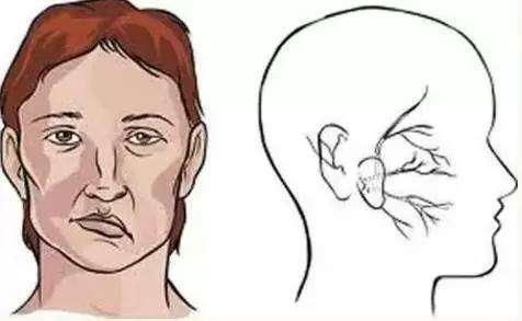 （一）肌肉痉挛与神经兴奋性增较高