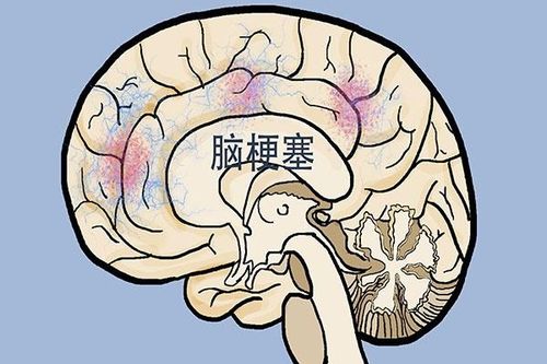 5. 狮子座——自信强势且偏爱浓重口味