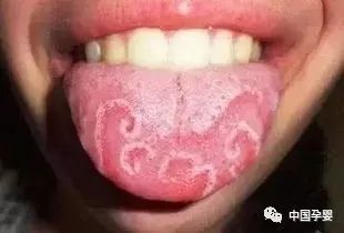 二、 过小舌头易漏：漏情漏财