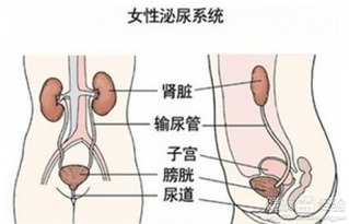 原因三：尿路感染
