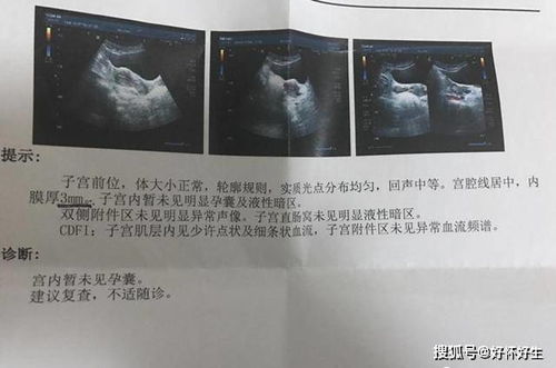 一、哪些叫“生化妊娠”？