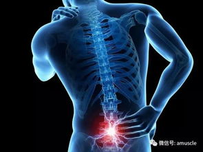 盆骨前倾，腰痛的元凶？