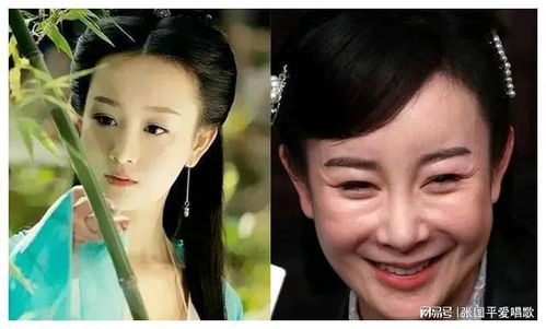 风华八字的人适合做哪些整容项目？