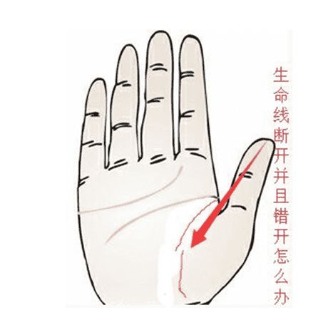 五、 生命線欠缺时 市场价格较高人線 的补救功能