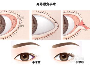 开眼角的风水原理是什么？风水眼睛图解大全有哪些？