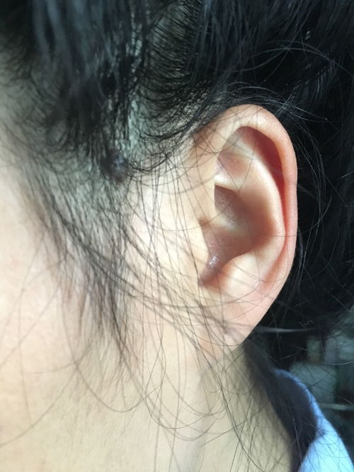 耳朵鬓角下方靠近耳朵的痣有什么风水含义？