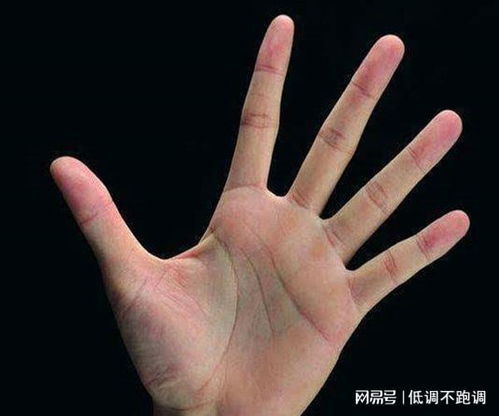 手相中若现小红点，这是否预示着什么特殊含义？