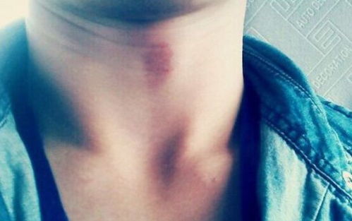 二、  颈椎状况对运势的影响