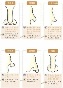 2.3 鼻翼丰满或饱满