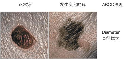 1.1 遗传基因的影响机制