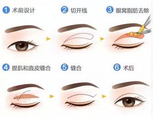 双眼皮爱情大方