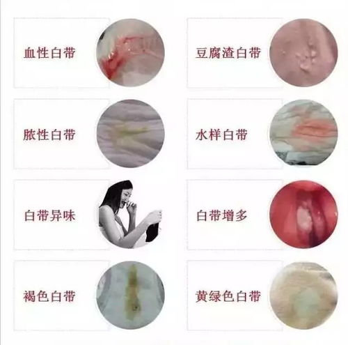 1-1 白带基本知识速递