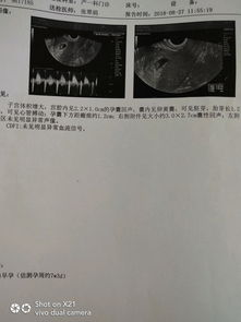 ：民间胎形观与当代医学理性之间的张力