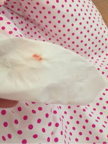 较小便时白带流出的真实相：是正常现象还是病症信号？