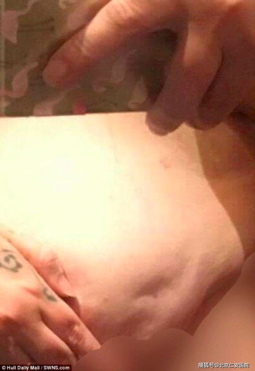 慢性疾病视域下的辟谷效应与局限性分析