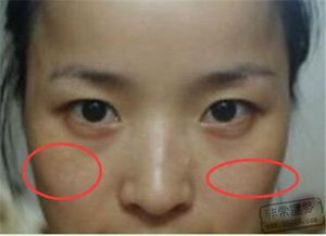 三、  颧骨与眉宇间的性格映射