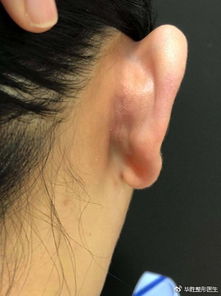 为什么我的左耳朵会突然发烫，这是不是有什么特殊含义呢？