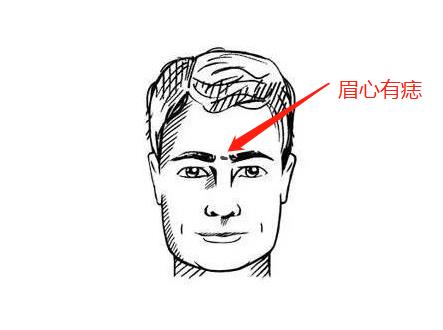 眉心长痣如何判断吉凶？图解分析？