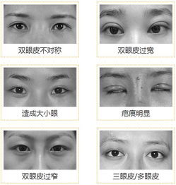 割双眼皮会对我的面相产生怎样的影响呢？