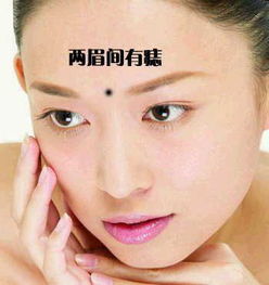 4.1 心理状态调摄与气色管理