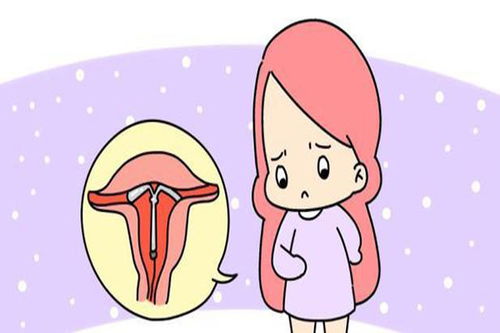 上环后的注意事项
