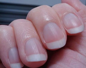 梦见剪指甲脱落或指甲被剪掉预示着什么？