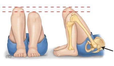 如何同过观察女生走路八字脚来判断其八字命理？