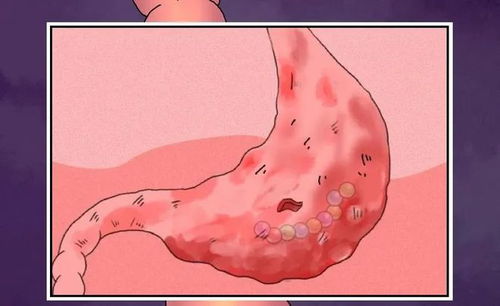四、 “rubber bean disease ” 与传统方式禁忌之间的关联性